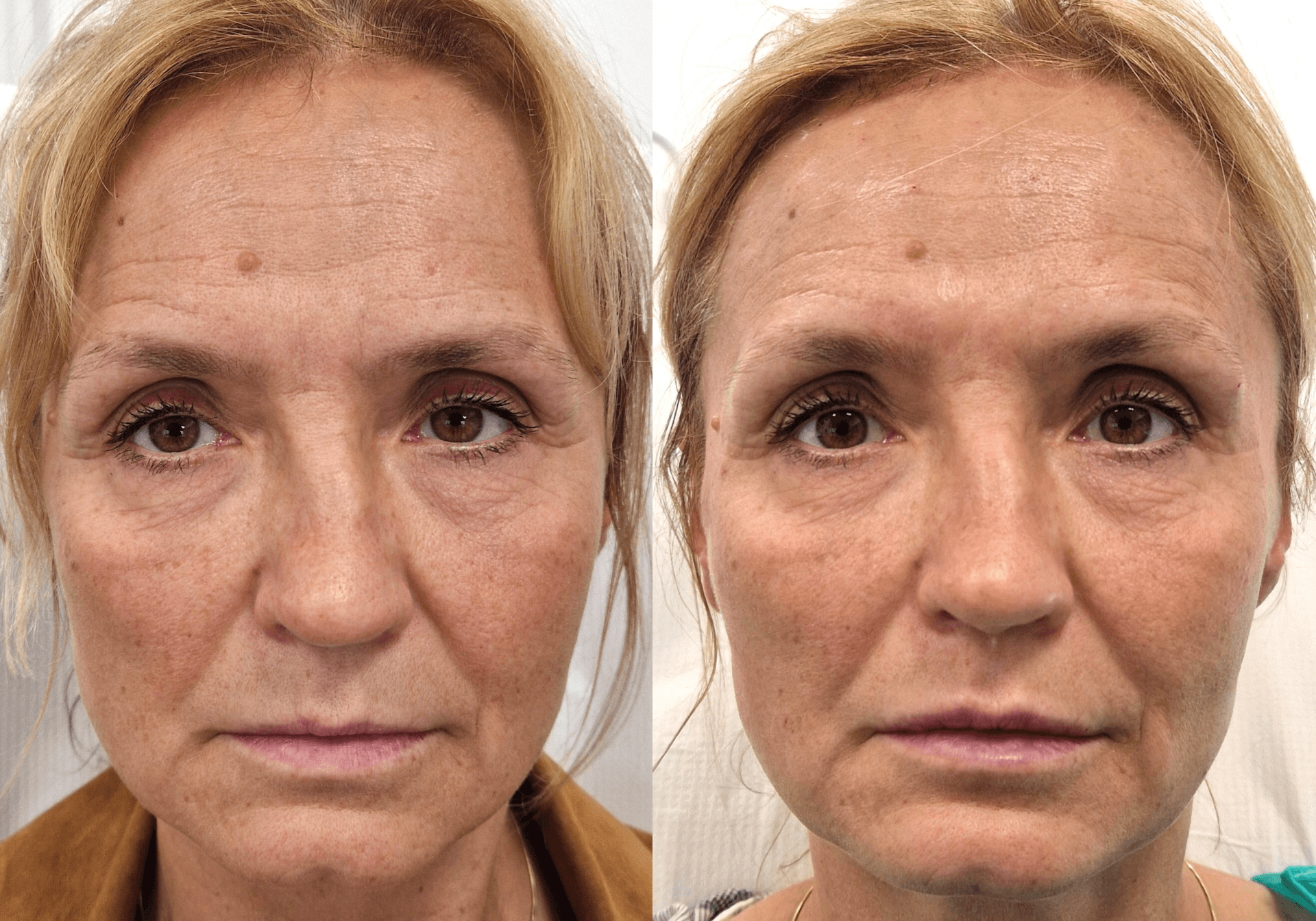 Metamorfoza dzień matki