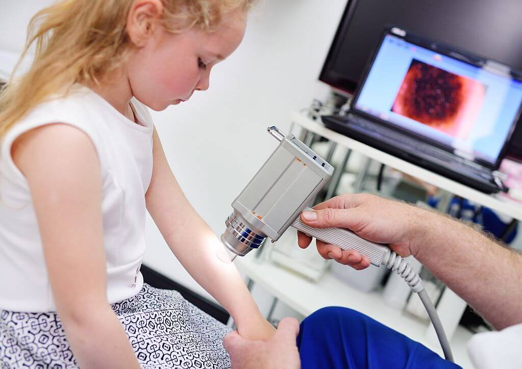 videodermatoskopia_i_metody_usuwania_znamion